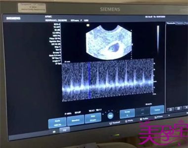 40岁周女士高龄要二胎，美国第三方辅助生殖喜得男宝宝