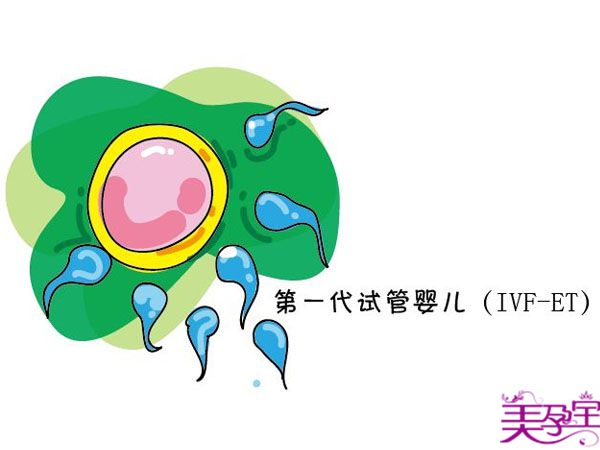 试管一代、二代、三代区别以及适用人群？