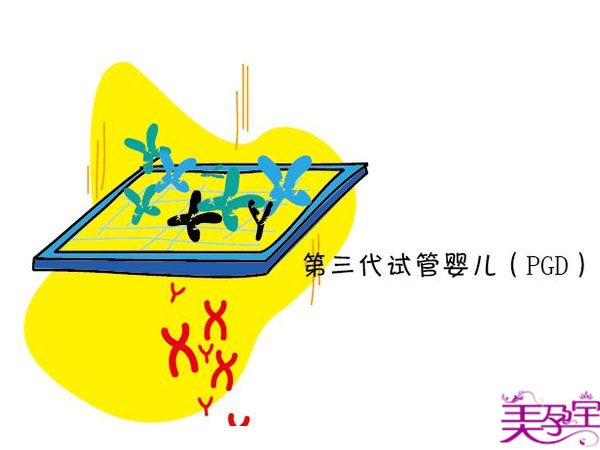 试管一代、二代、三代区别以及适用人群？