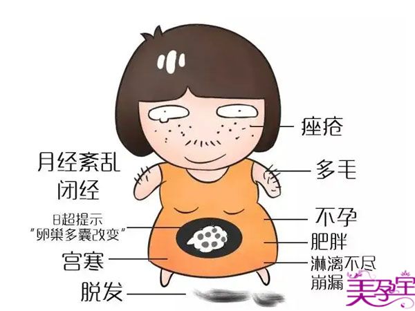 多囊卵巢做试管婴儿成功率高吗?